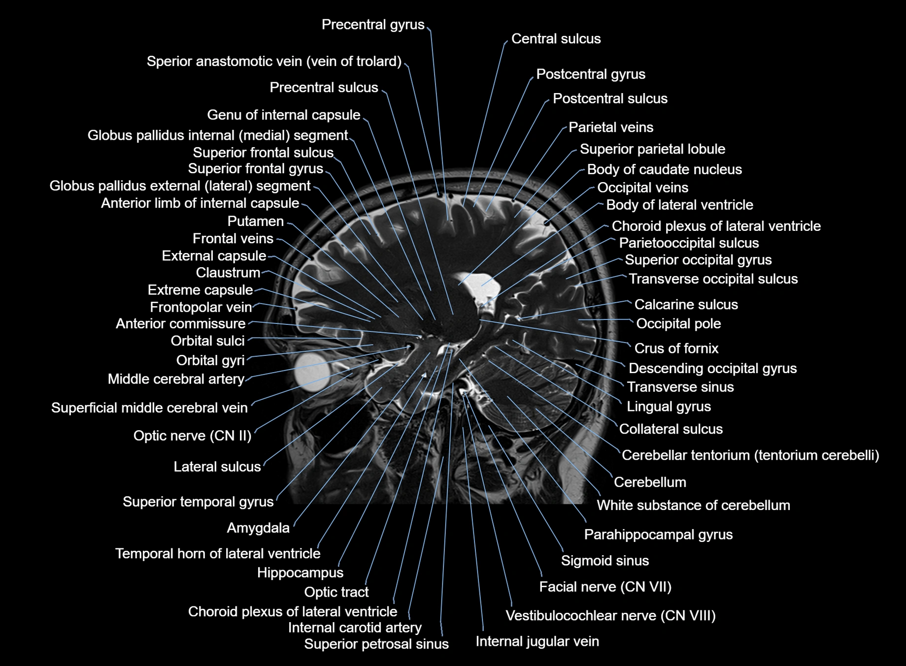 brain sagittal anatomy 3T MRI images -img-00001-00023.webp